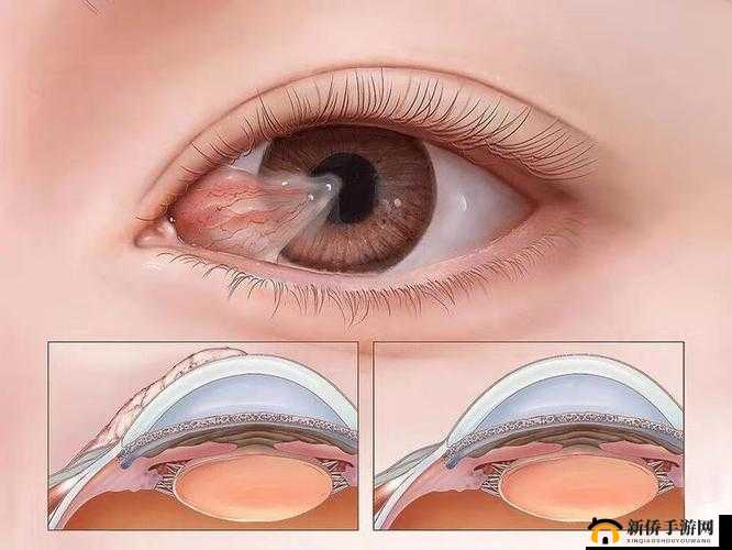 获得超级胬肉系统怎么办：这可咋整