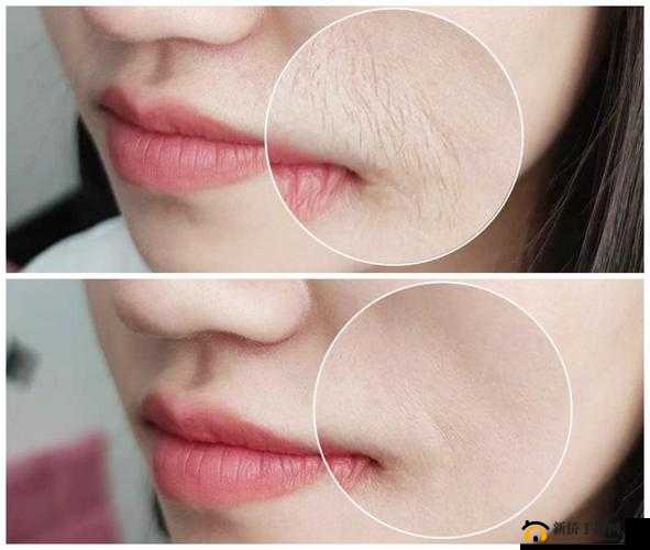 青春期女生唇毛：会自己脱落吗？