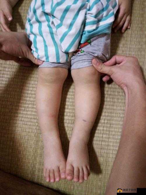 宝贝腿张大点就不疼了雷安：别样情感的交织