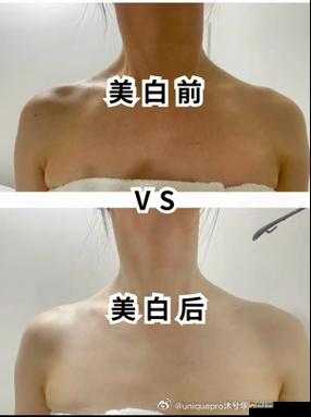 妈妈美白蚌埠是私人的吗：医美争议与个人选择