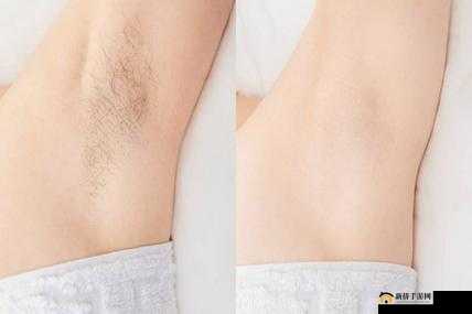 女性大荫蒂荫道多毛茸茸：探讨女性生理特征