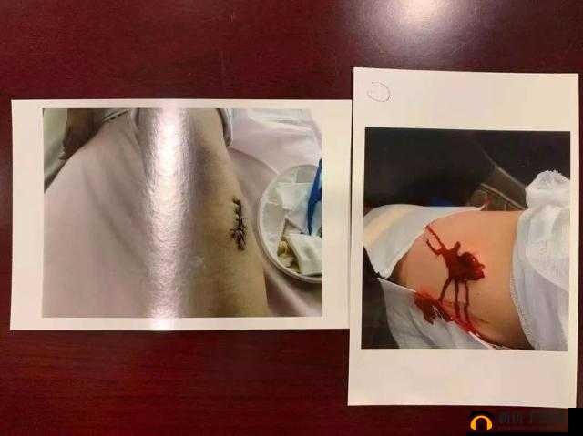 9 分 42 秒头撞玻璃会带来怎样的后果