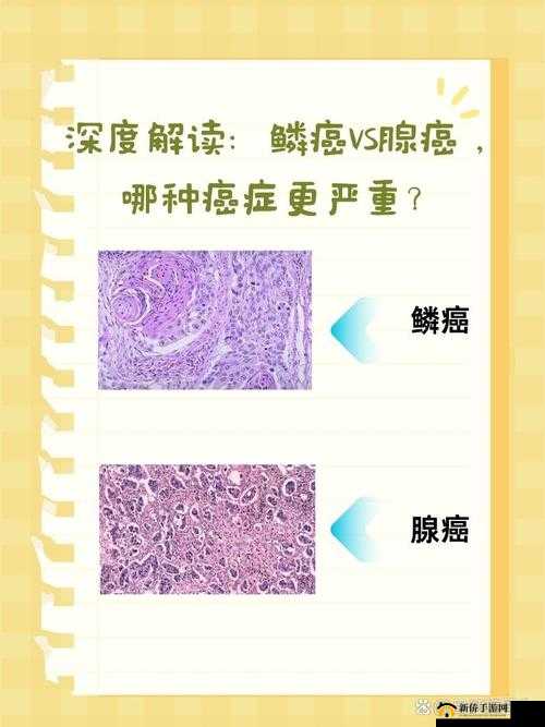 日产 MV 与欧美 MV 的异同点解析：深度探讨