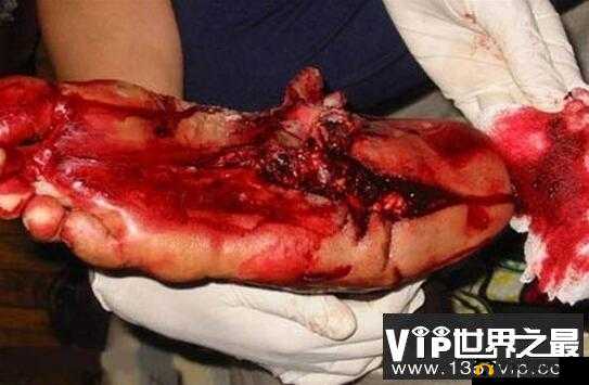 一个人吃下另一个人的奇特画面