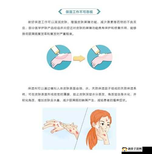 翁止熄痒最简单处理方法：快速止氧，让你不再瘙痒难耐