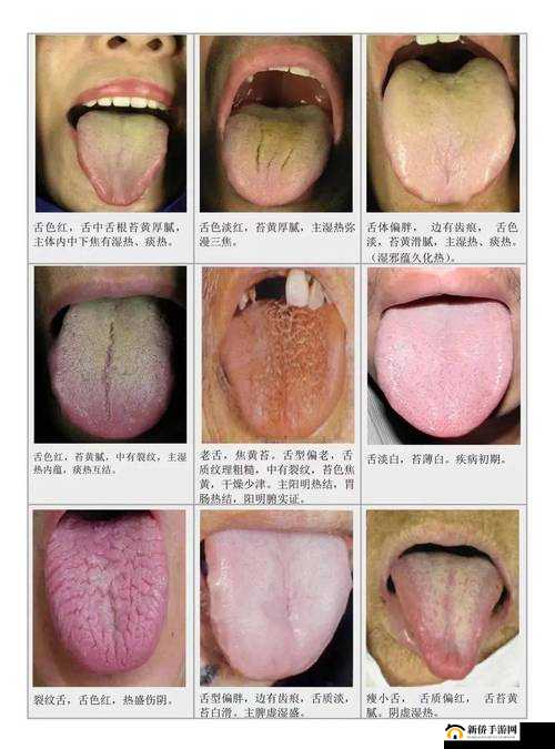 老中医李雪妮排阴毒：独特中医疗法探秘