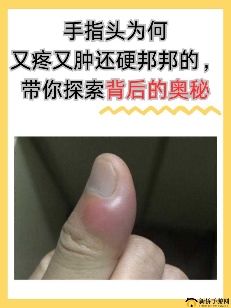 三根手指引发的剧痛