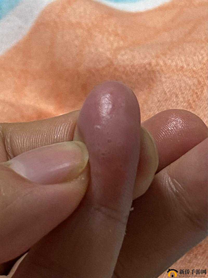 才三根手指头就疼了小东西：这到底是怎么回事呢