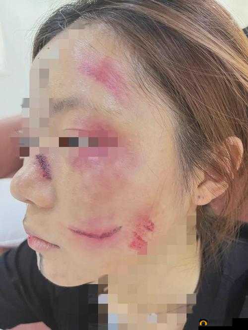 ：女子与情人在家中发生性关系，被丈夫发现后反遭暴打