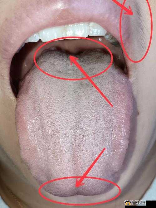 舌头往下舔到一个硬硬的包疼：探寻这一异常现象的根源