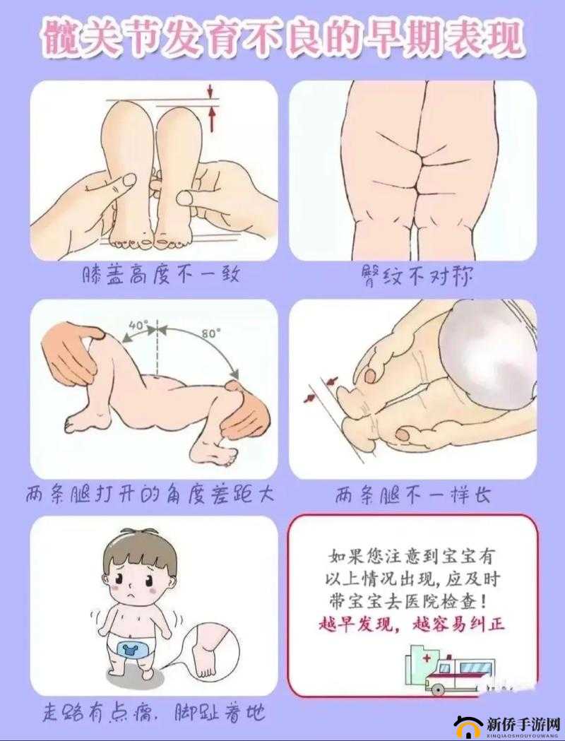 宝贝腿往外打开一点疼痛即消的实用小妙招