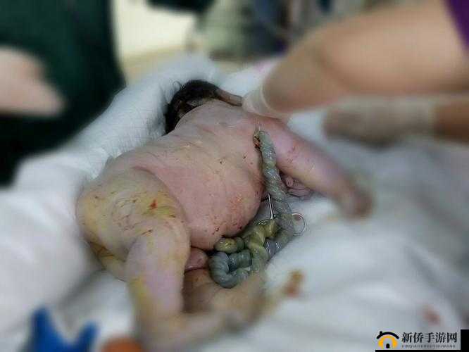 胎头湿漉漉挤出来时的应对方法及注意事项