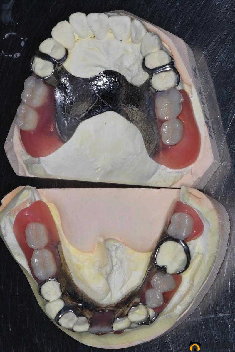 假牙医生高效技巧，如何迅速完成牙齿矫正与治疗方案