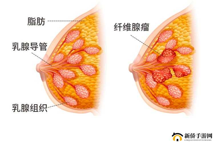 18 岁少女乳房硬块，令人担忧