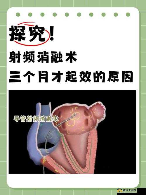 433MHz 射频对人体健康的潜在影响之深入探究与全面分析