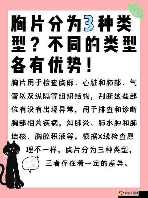 胸片曝光软件哪个好用以及相关软件的特点和优势介绍