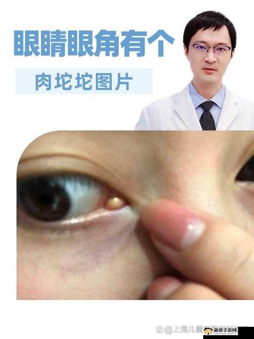 如何应对获得超级胬肉系统这一情况