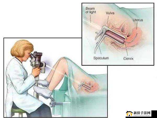 妇科分泌物取标本怎么做？一文详解正确的操作方法与注意事项